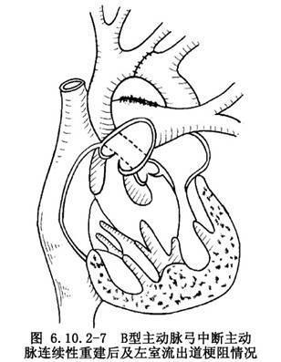 心脏血管结构图简笔画